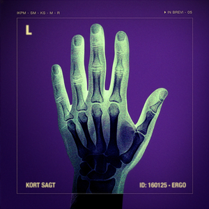 Ingen Kys På Motorvejen