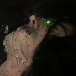 skin2