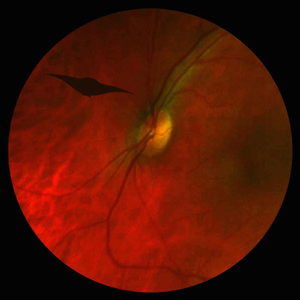 To End Up There (Live)