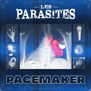 Pacemaker