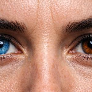 (Right) Eye Open