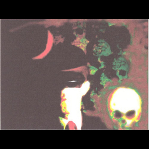 A Requiem for the Prophet of Doom (Flatbush Mix)