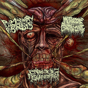 Decrepitated Regurgitations in Foetal Leprosy (Last Days of Humanity Cover)
