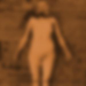 Of an Anencephalic Accident in 1989