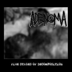 ADENOCARCINOMA