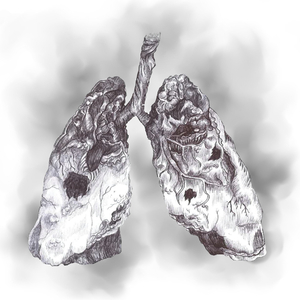 Smoker's Lungs