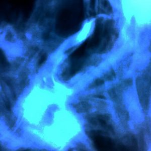 "Euphoria" Gunna x Ferno Type Beat