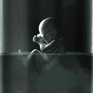 Dream 01011000