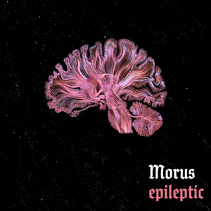 epileptic (Extended Version)