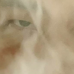 급격다중방어기제