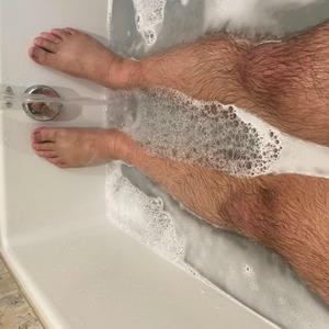 I Fell on My Bicycle