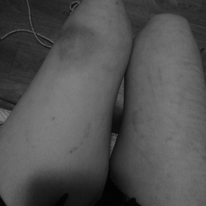 Альтернативы