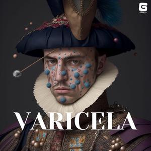 Varicela