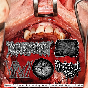 Viral Embryo Dementia Bacteria
