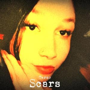 Scars