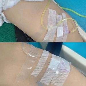 抗癌（女）