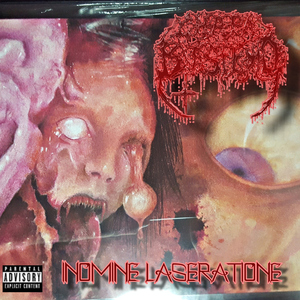 Inomine Laseratione