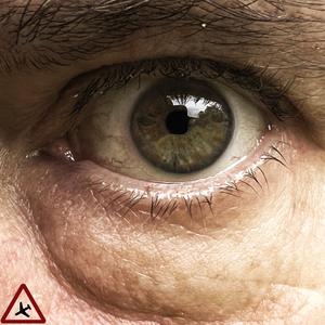 Eye