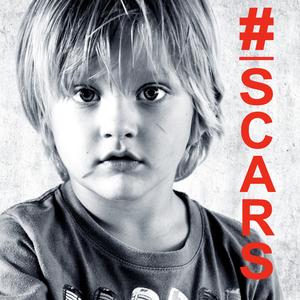 Scars (feat. Mitch) [Late Night Instrumental] (Instrumental)