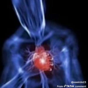 acid (feat. Standard)