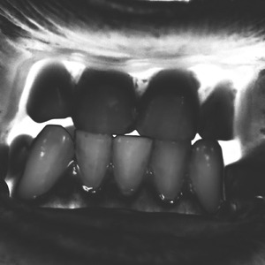 Zubeidaa (Full Set of Teeth)
