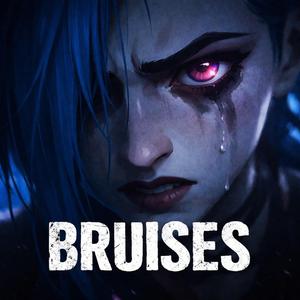 Bruises