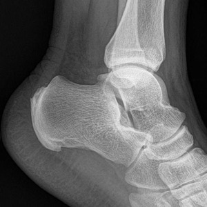 Bagaimana Jika Kristen Yang Masuk Surga?