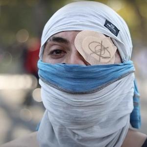 Baquedano (¿Qué Pasó Abajo?)