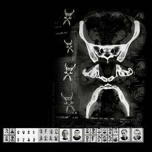 It's Parents Like You That Are Flies on the Horse's Face (feat. Dylan Nyoukis)