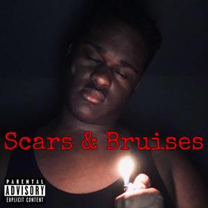 Scars & Bruises