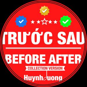 TRƯỚC SAU - BEFORE AFTER (08 COLLECTION Version)