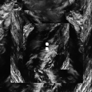 Повзрослей (Live)