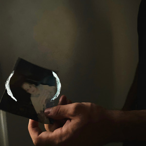 Lembrança (Como Esquecer?)