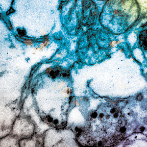 Conversation With an Old Tree