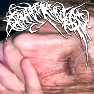 Фосфены