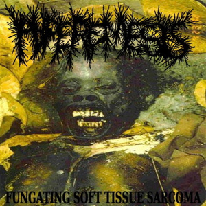 Butyric Fermentation