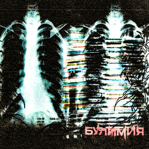 Булимия