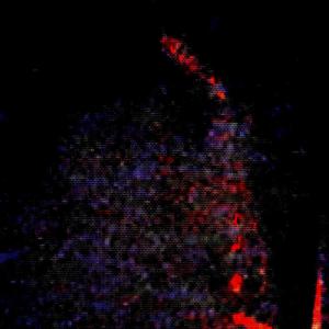 Antidepressivos (Continuação)