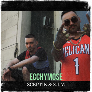 Ecchymose