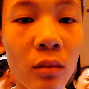 我的兄弟常浩源因打球而受伤了