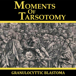 Cauliflower-Like Growths of Condyloma Acuminatum