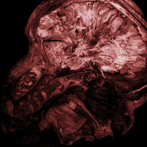 Thanatopsis - A View Of Death