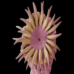 Tapeworm