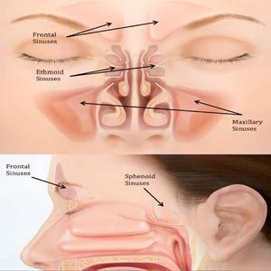 it's my screwed up nose he should know everything express yourself find out who is in my nose and how the incident is slow ****, slow