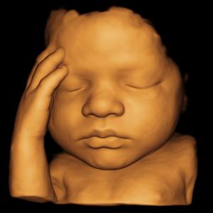 You Are My Fire (The Only One)