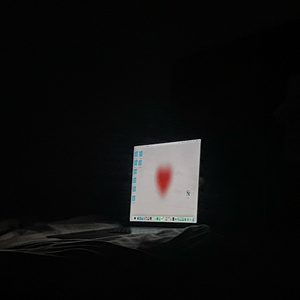 Parantez (Acoustic Version)