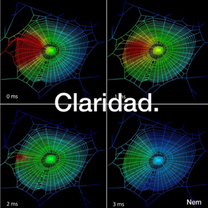 Claridad