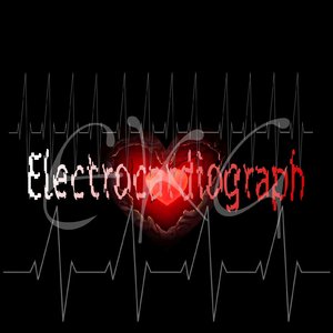 Electrocardiogram