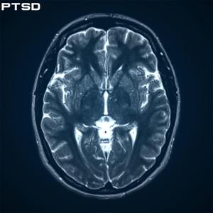 PTSD