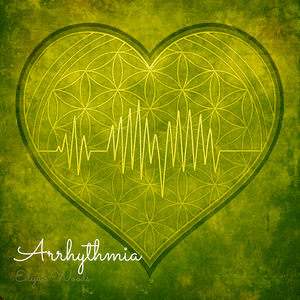 Arrhythmia